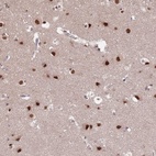 Anti-ST5 Antibody