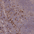 Anti-MPEG1 Antibody