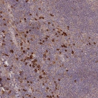 Anti-MPEG1 Antibody