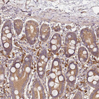 Anti-C6orf136 Antibody