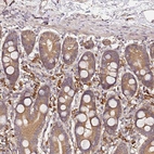 Anti-C6orf136 Antibody