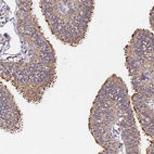 Immunohistochemical staining of human fallopian tube shows strong cytoplasmic positivity in glandular cells.