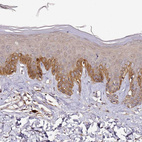 Immunohistochemical staining of human skin shows strong cytoplasmic positivity in squamous epithelial cells.