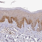 Immunohistochemical staining of human skin shows strong cytoplasmic positivity in squamous epithelial cells.