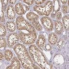Immunohistochemical staining of human kidney shows strong cytoplasmic positivity in cells in tubules.