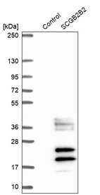 Western blot analysis in control (vector only transfected HEK293T lysate) and SCGB2B2 over-expression lysate (Co-expressed with a C-terminal myc-DDK tag (~3.1 kDa) in mammalian HEK293T cells, LY422450).