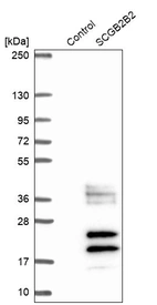 Western blot analysis in control (vector only transfected HEK293T lysate) and SCGB2B2 over-expression lysate (Co-expressed with a C-terminal myc-DDK tag (~3.1 kDa) in mammalian HEK293T cells, LY422450).