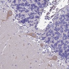 Anti-FAM69B Antibody