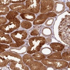 Anti-ATAT1 Antibody