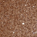 Anti-ARL17A Antibody