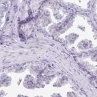 Immunohistochemical staining of human prostate shows low expression as expected.