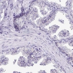 Immunohistochemical staining of human prostate shows low expression as expected.