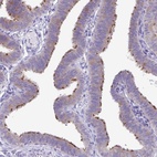 Immunohistochemical staining of human fallopian tube shows high expression.