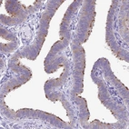 Immunohistochemical staining of human fallopian tube shows high expression.