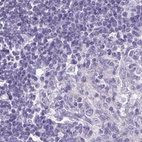 Anti-CAPSL Antibody