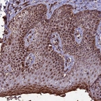 Immunohistochemical staining of human skin shows strong nuclear positivity in squamous epithelial cells.