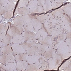 Immunohistochemical staining of human skeletal muscle shows moderate nuclear positivity in myocytes.