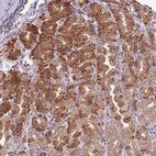 Anti-SCAF1 Antibody