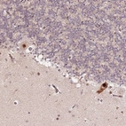 Anti-CCNYL1 Antibody