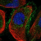 Immunofluorescent staining of human cell line A-431 shows localization to plasma membrane.