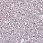 Immunohistochemical staining of human liver shows very weak positivity in hepatocytes as expected.