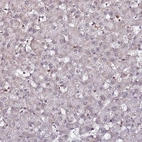 Immunohistochemical staining of human liver shows very weak positivity in hepatocytes as expected.