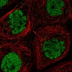 Immunofluorescent staining of human cell line A-431 shows localization to nucleoplasm.