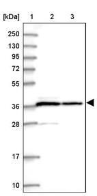 Lane 1: Marker [kDa] 250, 130, 95, 72, 55, 36, 28, 17, 10_br/_Lane 2: Human cell line RT-4_br/_Lane 3: Human cell line U-251 MG
