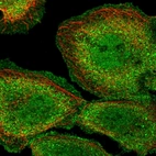 Immunofluorescent staining of human cell line A-431 shows localization to nucleoplasm, plasma membrane & cytosol.