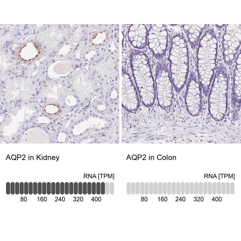 Anti-AQP2 Antibody