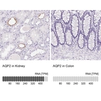 Anti-AQP2 Antibody