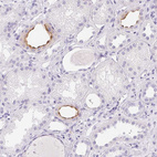 Immunohistochemical staining of human kidney shows moderate positivity in luminal membrane in cells in tubules.
