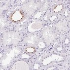 Immunohistochemical staining of human kidney shows moderate positivity in luminal membrane in cells in tubules.