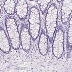 Immunohistochemical staining of human colon shows no cytoplasmic positivity in glandular cells as expected.