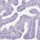 Immunohistochemical staining of human fallopian tube shows no positivity in glandular cells as expected.