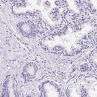 Immunohistochemical staining of human prostate shows no positivity in as expected.