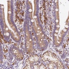 Anti-DDOST Antibody