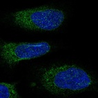 Immunofluorescent staining of human cell line U-2 OS shows localization to endoplasmic reticulum.
