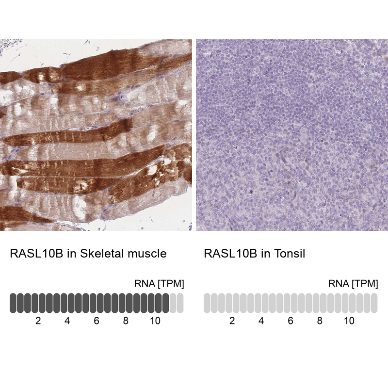 Anti-RASL10B Antibody