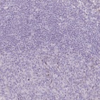 Immunohistochemical staining of human tonsil shows low expression as expected.