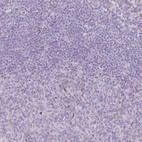 Anti-RASL10B Antibody