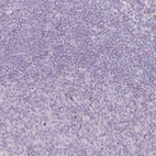 Immunohistochemical staining of human tonsil shows low expression as expected.