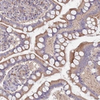 Anti-MALRD1 Antibody
