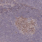 Immunohistochemical staining of human lymph node shows high expression.
