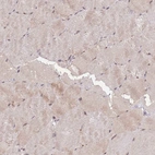 Immunohistochemical staining of human skeletal muscle shows low expression as expected.