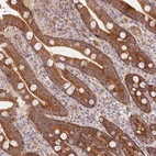 Anti-UQCC3 Antibody