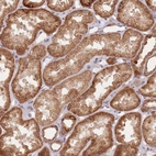 Immunohistochemical staining of human kidney shows strong cytoplasmic granular positivity in cells in tubules.