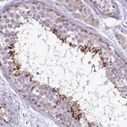 Immunohistochemical staining of human testis shows strong cytoplasmic positivity in spermatids.