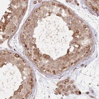 Immunohistochemical staining of human testis shows moderate cytoplasmic granular positivity in cells in seminiferous ducts and Leydig cells