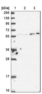 Lane 1: Marker [kDa] 250, 130, 95, 72, 55, 36, 28, 17, 10_br/_Lane 2: Human cell line RT-4_br/_Lane 3: Human cell line U-251MG sp